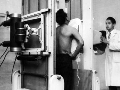 Foto em preto e branco de um paciente durante uma abreugrafia.